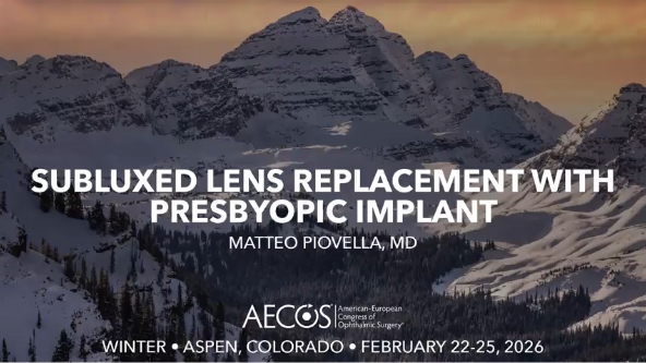 Subluxed Lens Replacement with Presbyopic Implant