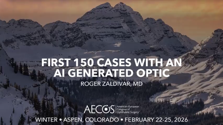 First 150 Cases with an AI Generated Optic