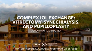 Complex IOL Exchange – Vitrectomy, Synechialysis, and Pupilloplasty