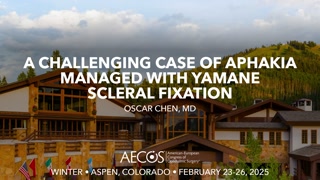 A Challenging Case of Aphakia Managed with Yamane Scleral Fixation
